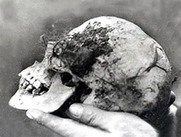 Photograph of the skull recovered from inside the hollow wych elm tree in Hagley Wood in 1943, associated with the unidentified woman known as “Bella.”